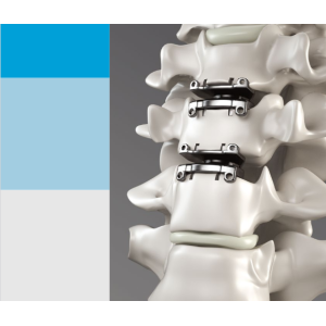 Prótese de Disco Cervical Prestige